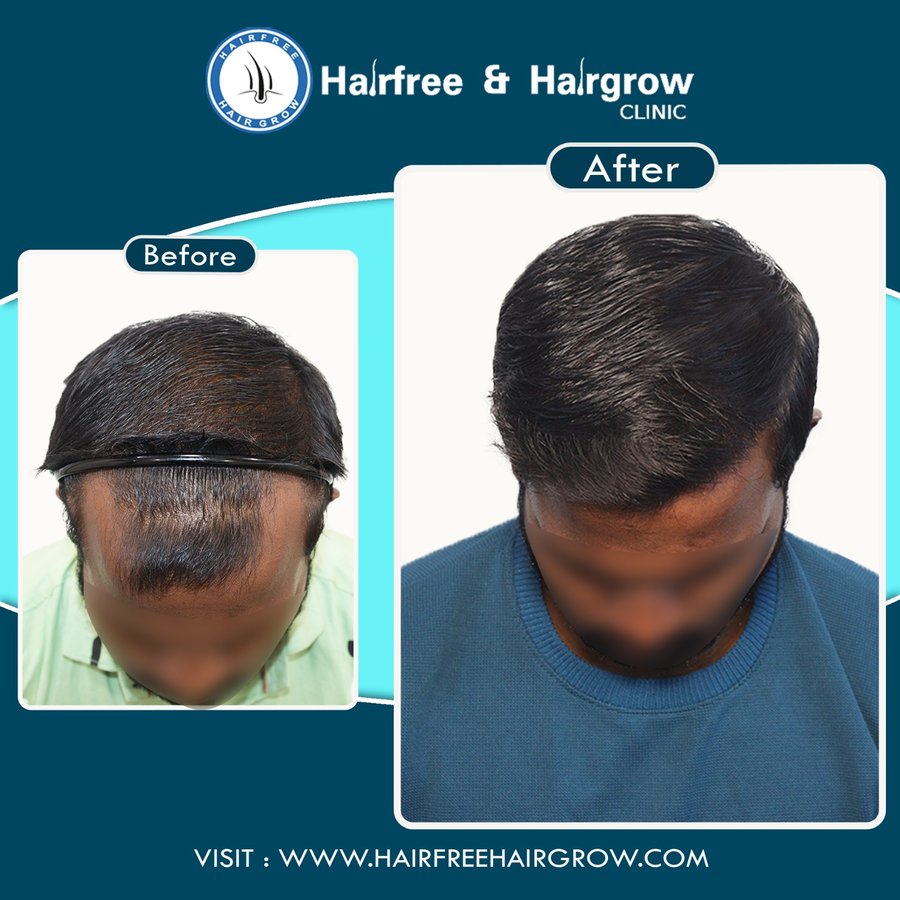 hairfree & hairgrow clinic - Vapi - hairfree & hairgrow clinic - Vapi