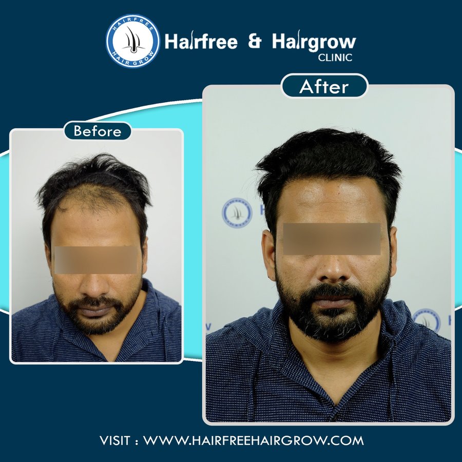 hairfree & hairgrow clinic - Vapi - hairfree & hairgrow clinic - Vapi