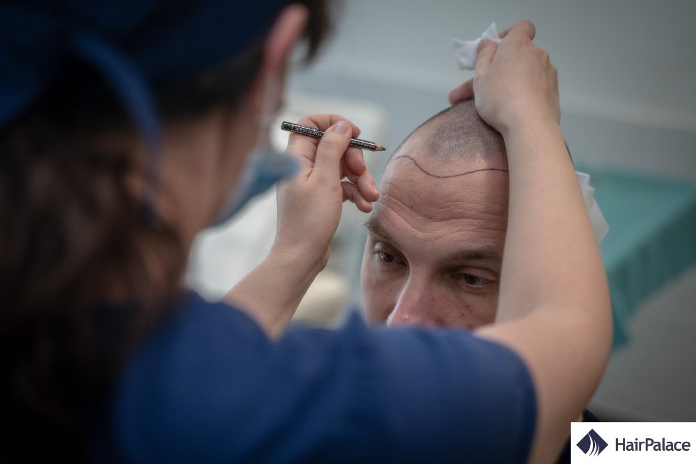 HairPalace Hair Transplant Clinic - HairPalace Hair Transplant Clinic