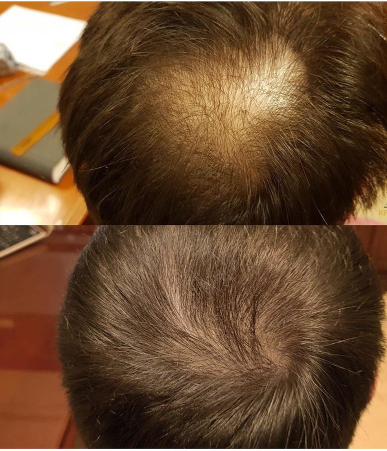HairVita - HairVita