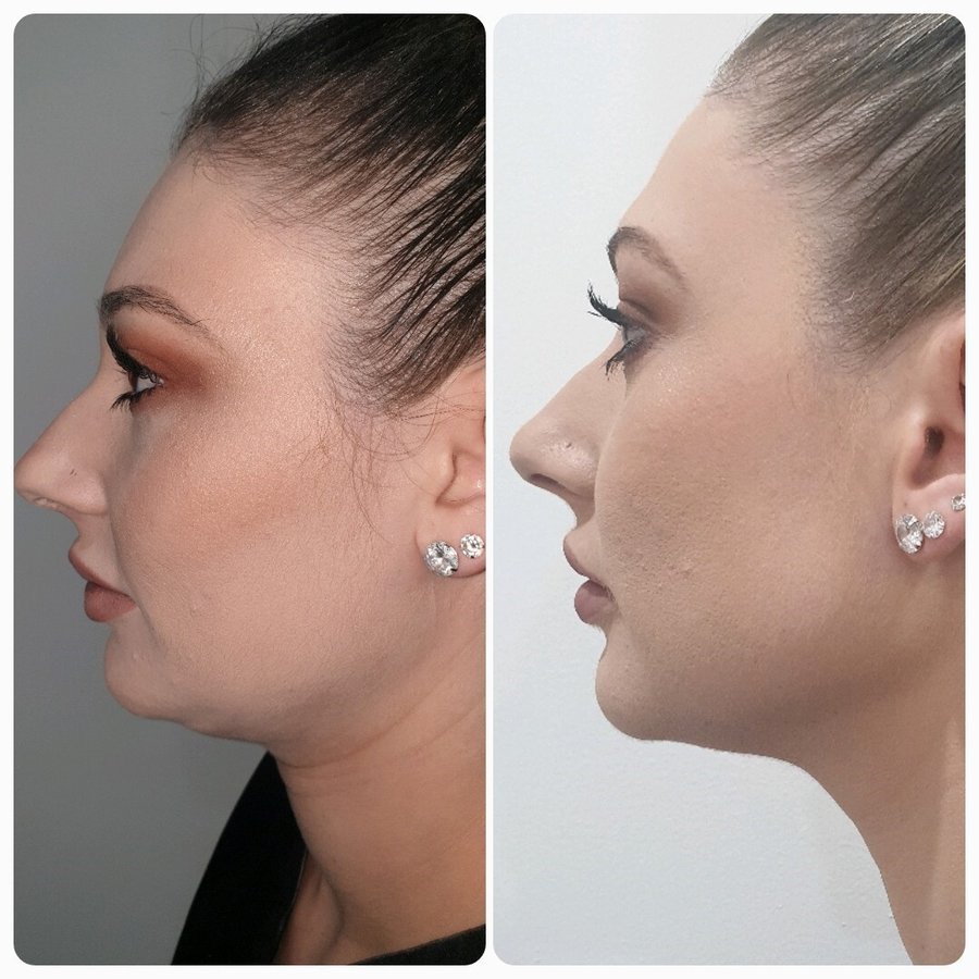 Hands On Laser and Beauty Therapy - Hands On Laser and Beauty Therapy