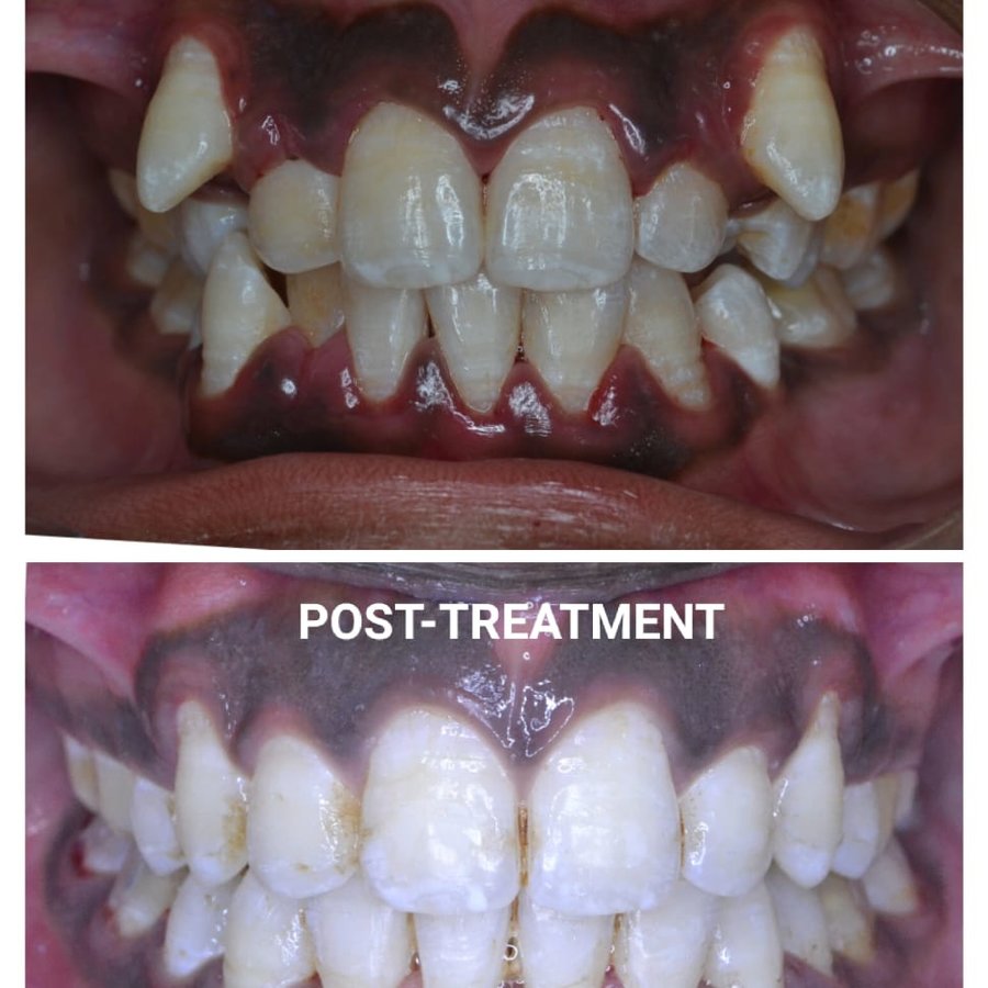 Happy Dental Clinic - Happy Dental Clinic