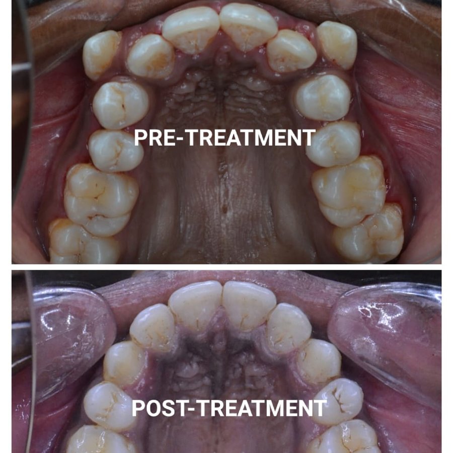 Happy Dental Clinic - Happy Dental Clinic