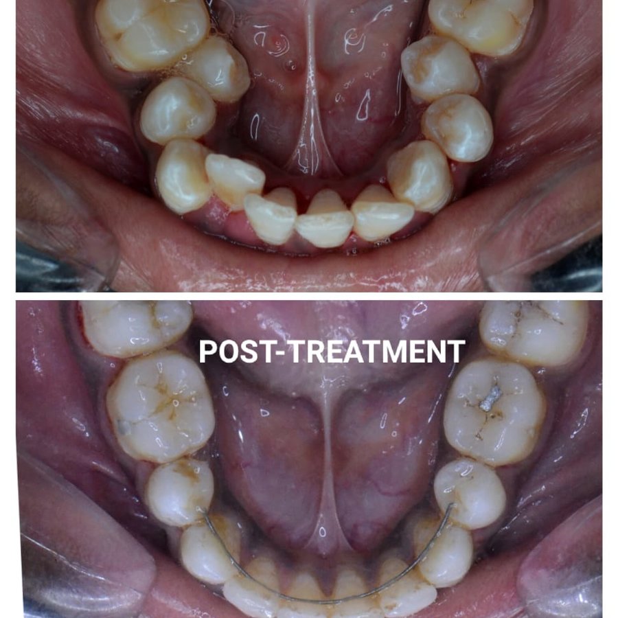 Happy Dental Clinic - Happy Dental Clinic