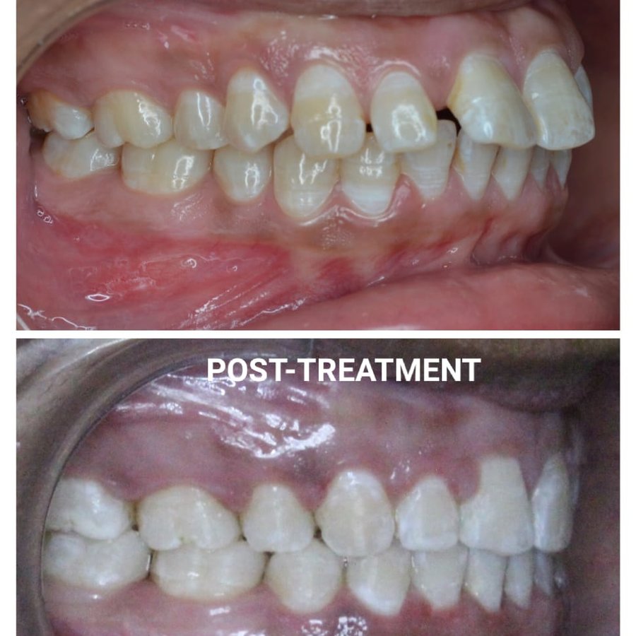 Happy Dental Clinic - Happy Dental Clinic