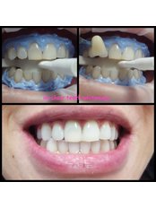 Happy Smiles Oral Hygiene & Teeth Whitening Studio - Happy Smiles Oral Hygiene & Teeth Whitening Studio