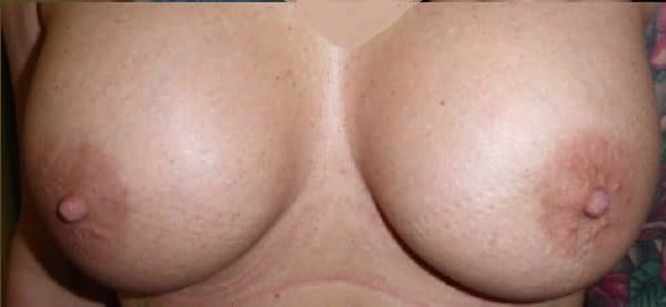 عيادة هارلي للثدي - Harley Breast Clinic