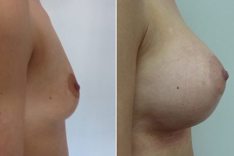 عيادة هارلي للثدي - Harley Breast Clinic