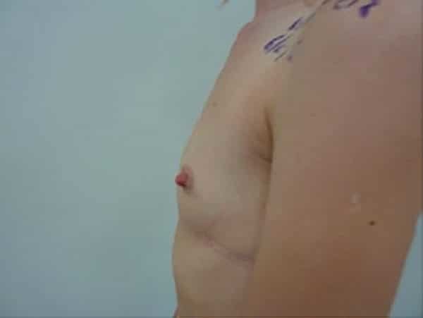 عيادة هارلي للثدي - Harley Breast Clinic