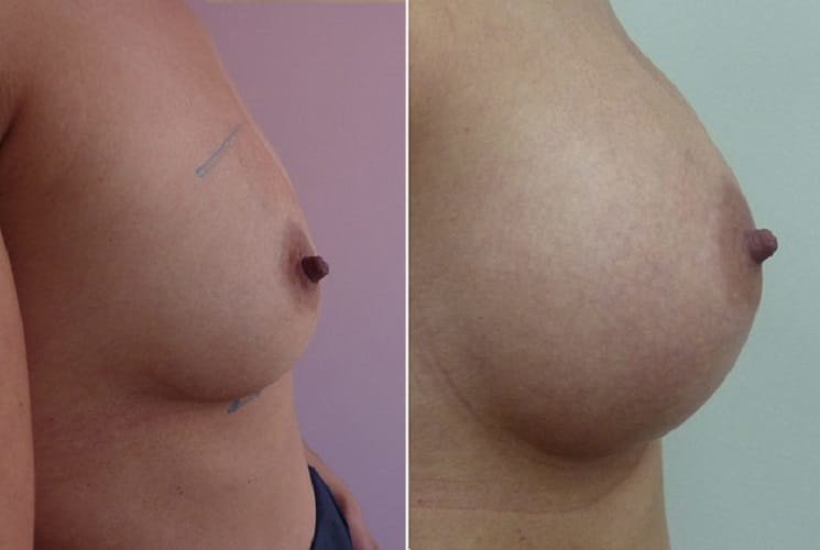عيادة هارلي للثدي - Harley Breast Clinic