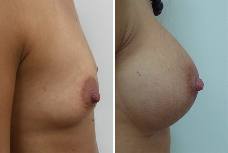 عيادة هارلي للثدي - Harley Breast Clinic