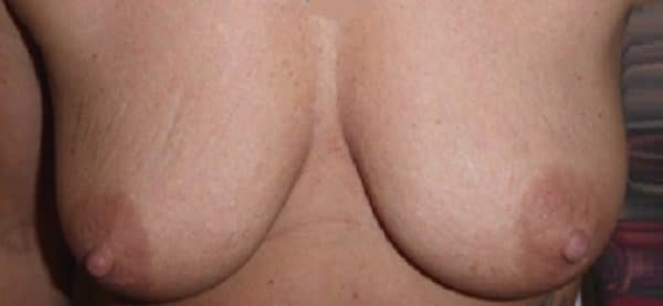 عيادة هارلي للثدي - Harley Breast Clinic