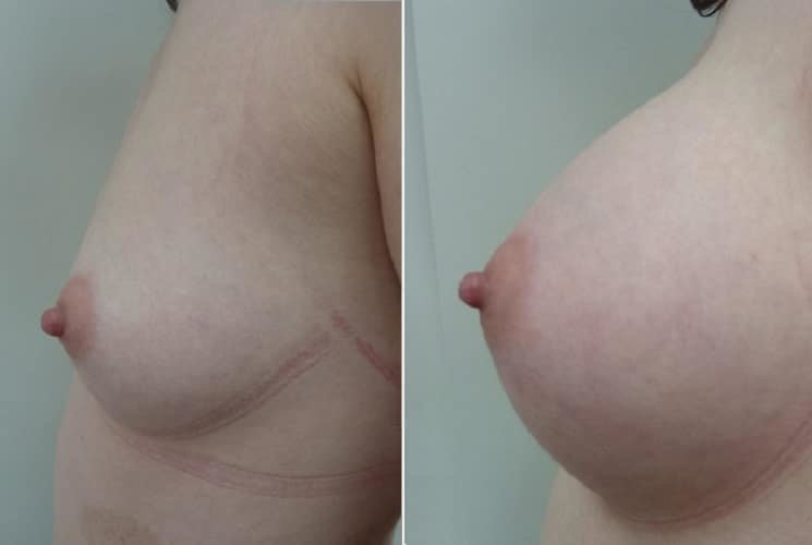 عيادة هارلي للثدي - Harley Breast Clinic