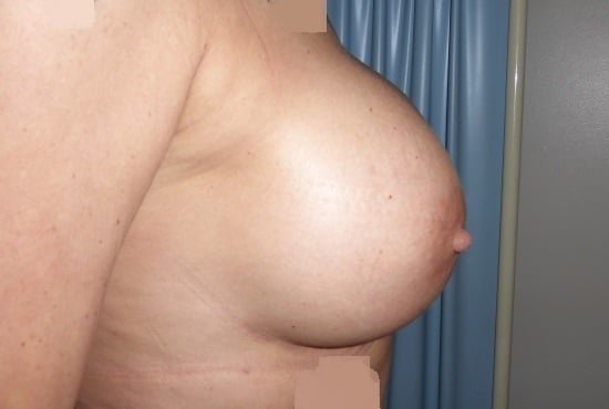 عيادة هارلي للثدي - Harley Breast Clinic