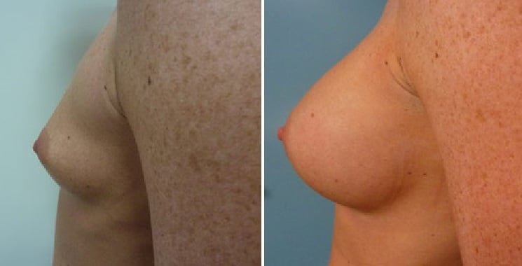 عيادة هارلي للثدي - Harley Breast Clinic