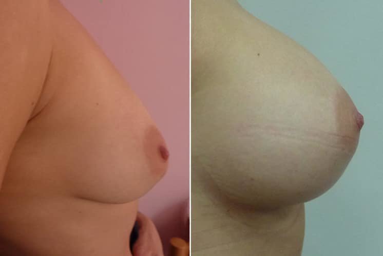 عيادة هارلي للثدي - Harley Breast Clinic