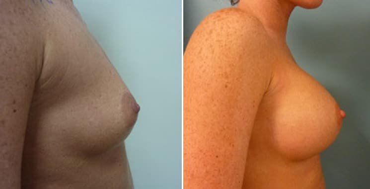 عيادة هارلي للثدي - Harley Breast Clinic