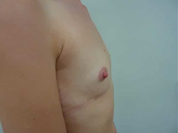 عيادة هارلي للثدي - Harley Breast Clinic