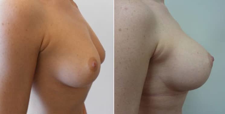 عيادة هارلي للثدي - Harley Breast Clinic