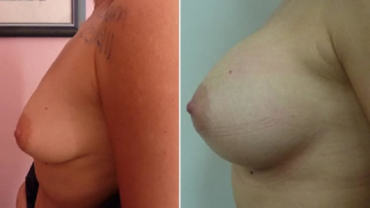 عيادة هارلي للثدي - Harley Breast Clinic