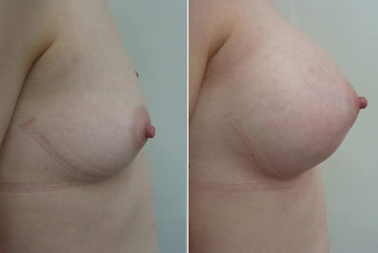 عيادة هارلي للثدي - Harley Breast Clinic