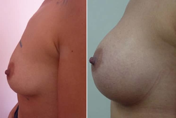 عيادة هارلي للثدي - Harley Breast Clinic