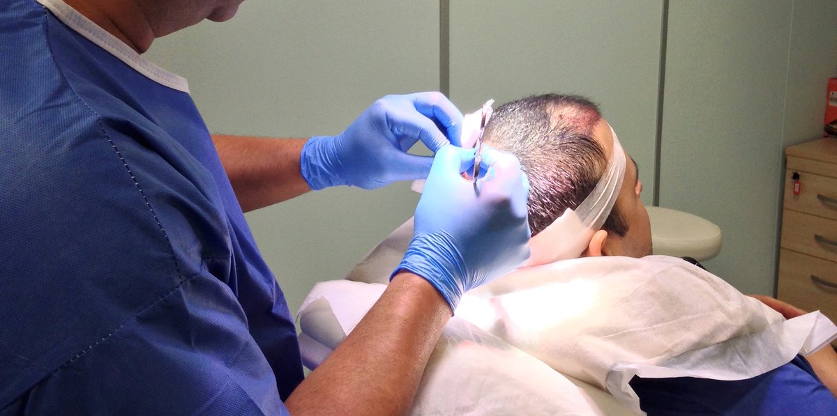 Harris Hair Transplant UK - Harris Hair Transplant UK