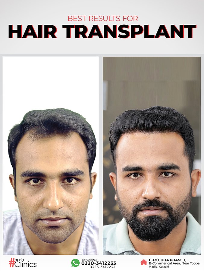 Hash Clinics - Hash Clinics