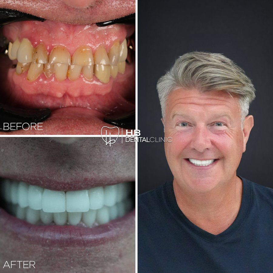 HB Dental Clinic - HB Dental Clinic