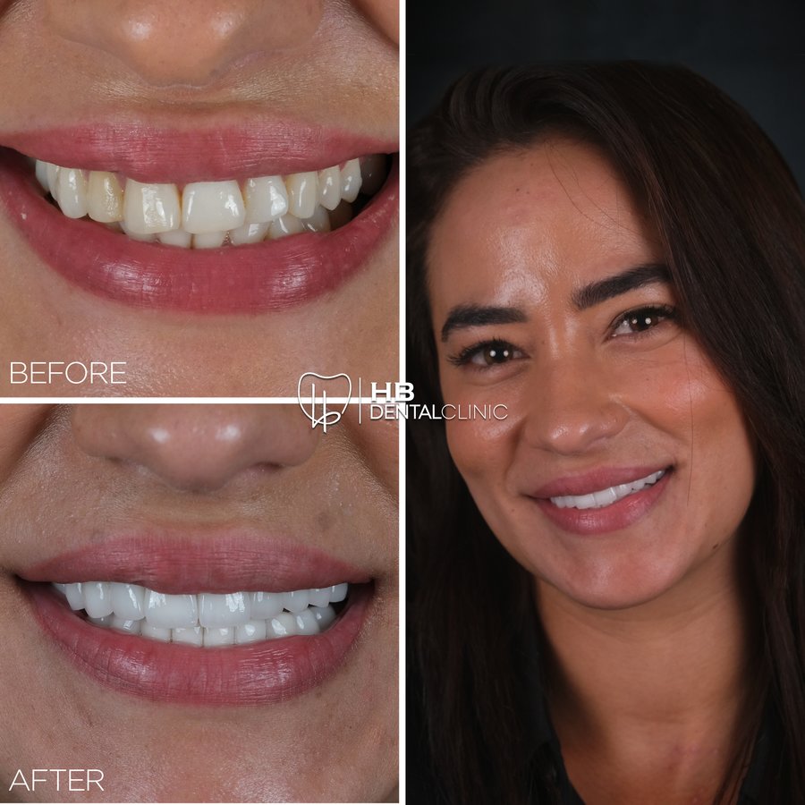 HB Dental Clinic - HB Dental Clinic