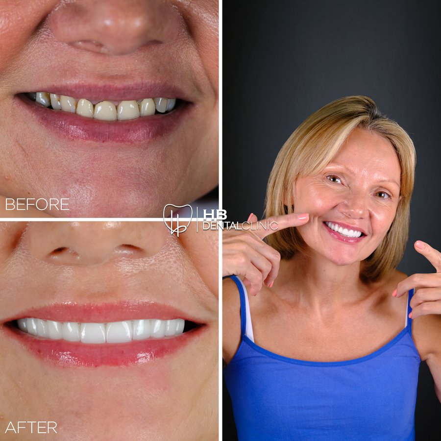 HB Dental Clinic - HB Dental Clinic