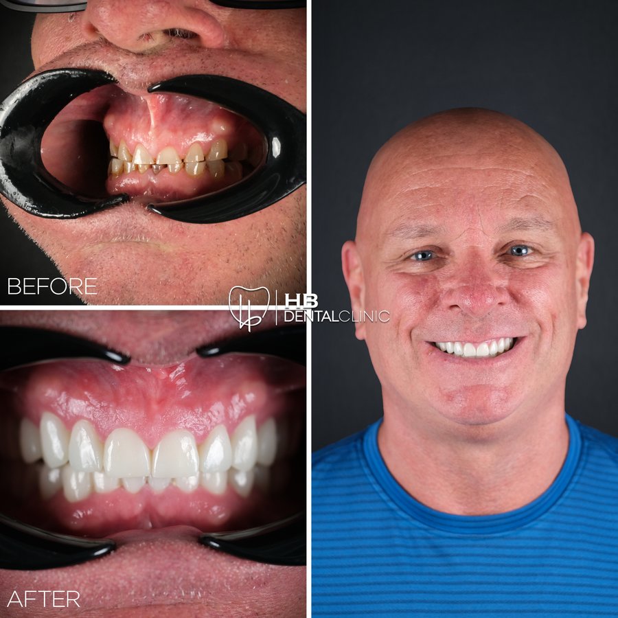 HB Dental Clinic - HB Dental Clinic