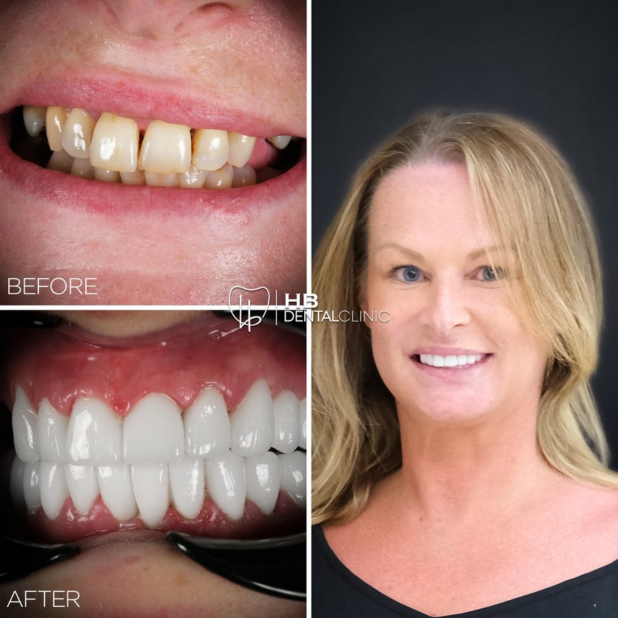 HB Dental Clinic - HB Dental Clinic