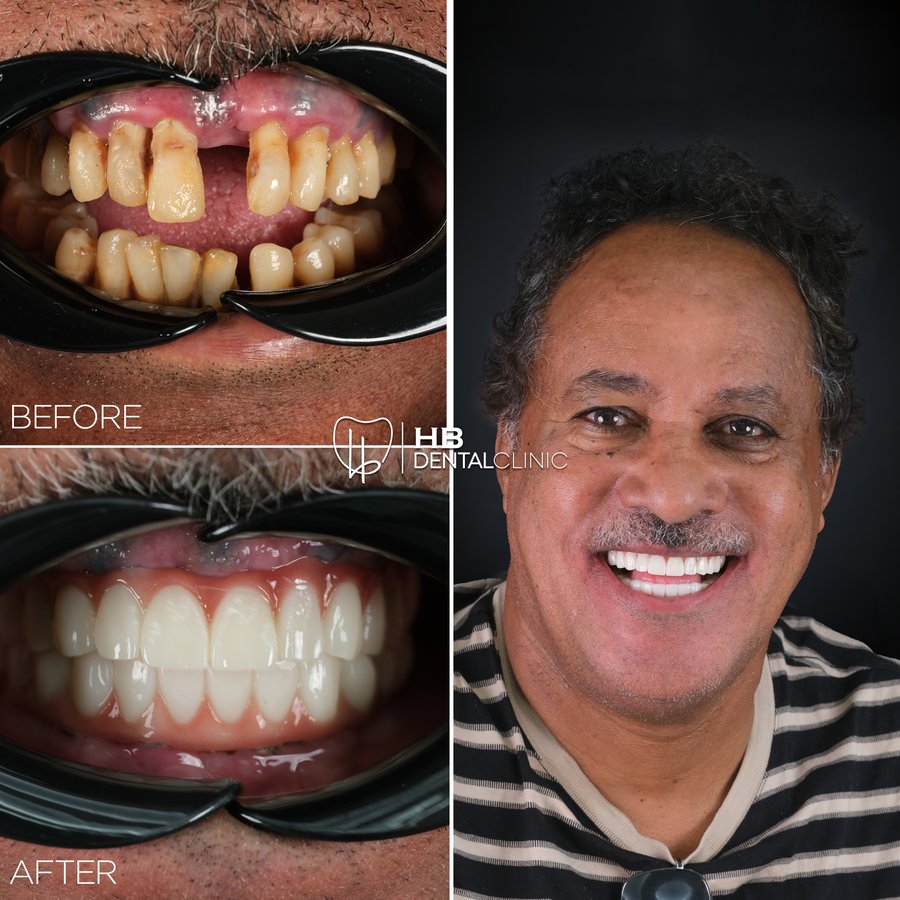 HB Dental Clinic - HB Dental Clinic