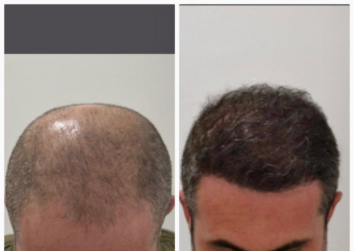 HCT Renova Clinic - HCT Renova Clinic