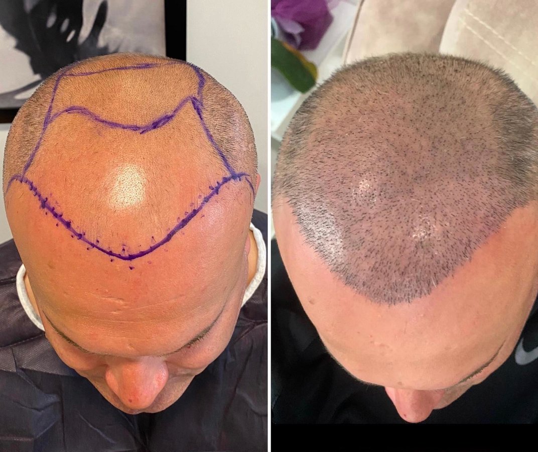 HCT Renova Clinic - HCT Renova Clinic