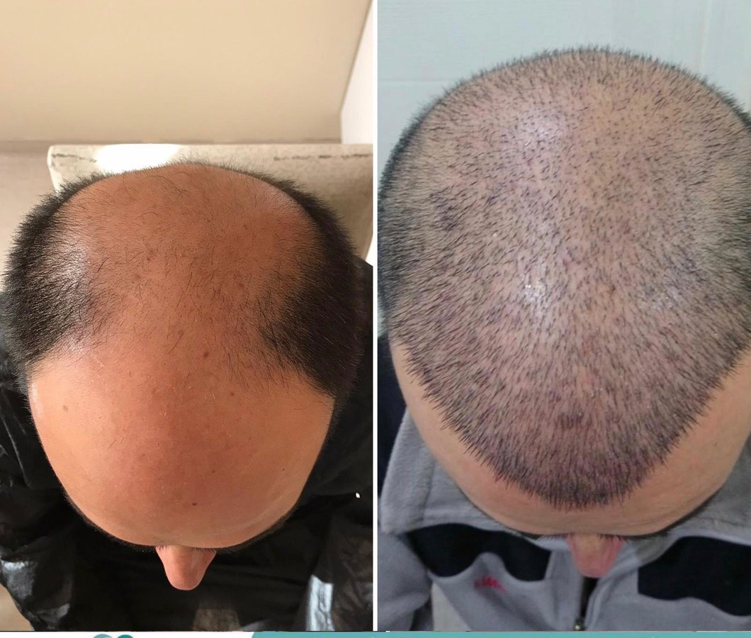 HCT Renova Clinic - HCT Renova Clinic