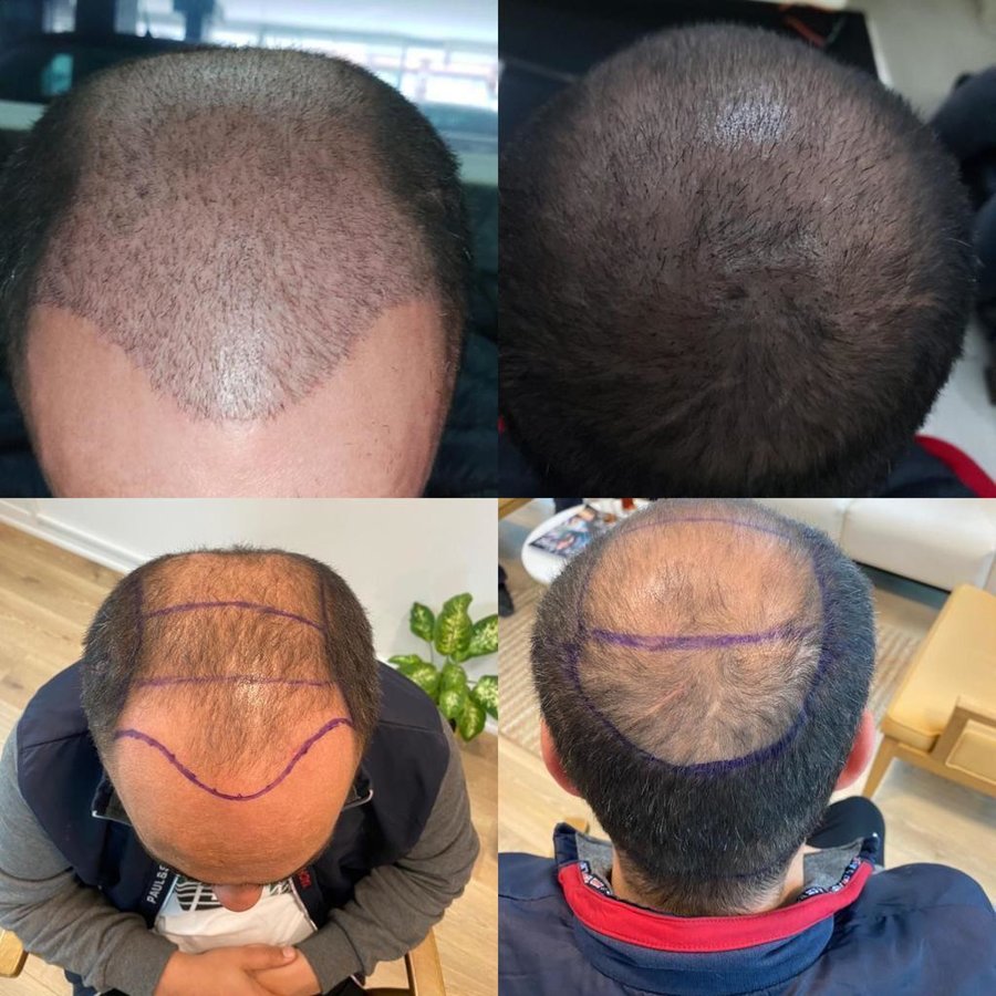 HCT Renova Clinic - HCT Renova Clinic