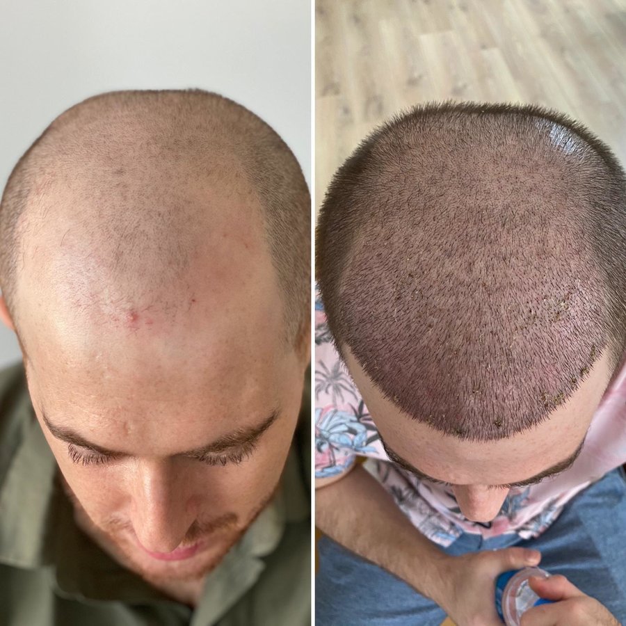 HCT Renova Clinic - HCT Renova Clinic