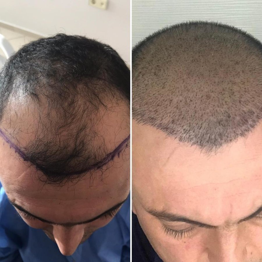 HCT Renova Clinic - HCT Renova Clinic