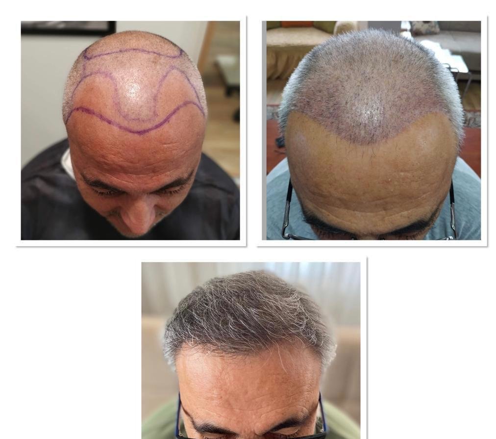 HCT Renova Clinic - HCT Renova Clinic