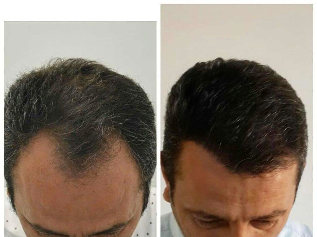 HCT Renova Clinic - HCT Renova Clinic