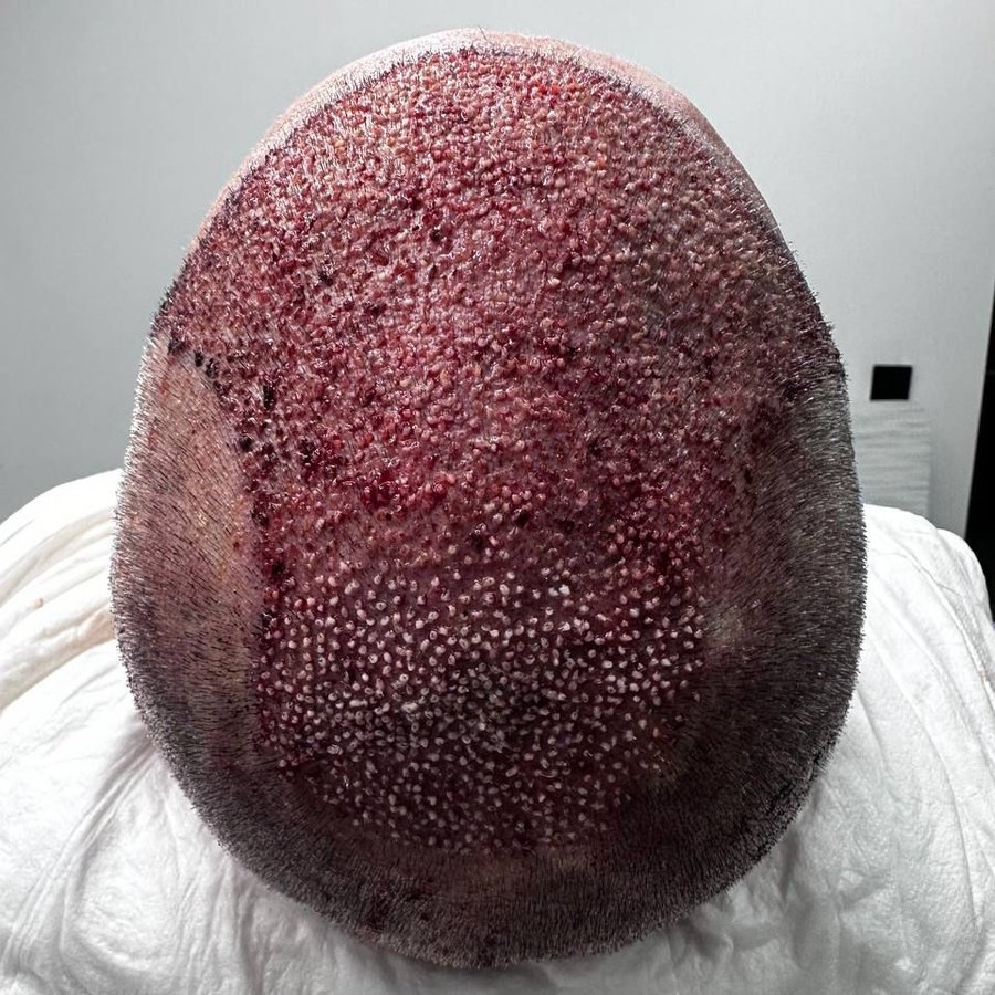 HCT Renova Clinic - HCT Renova Clinic