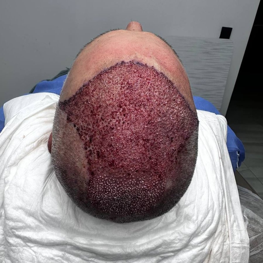 HCT Renova Clinic - HCT Renova Clinic