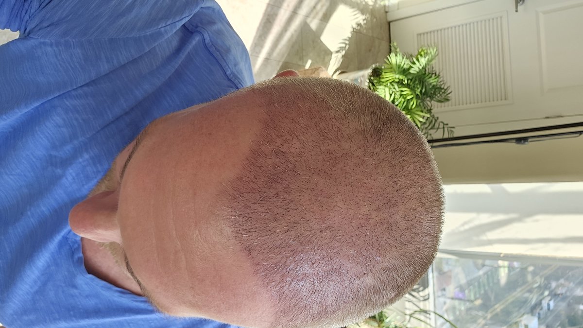 HCT Renova Clinic - HCT Renova Clinic