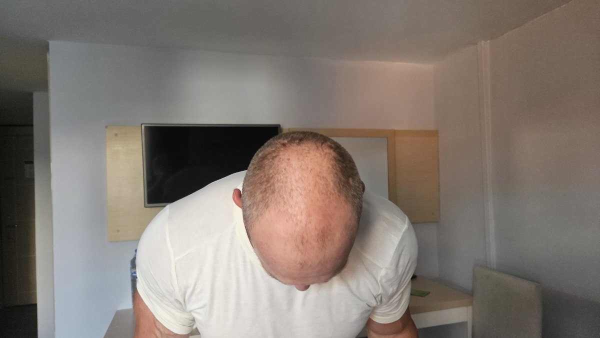 HCT Renova Clinic - HCT Renova Clinic