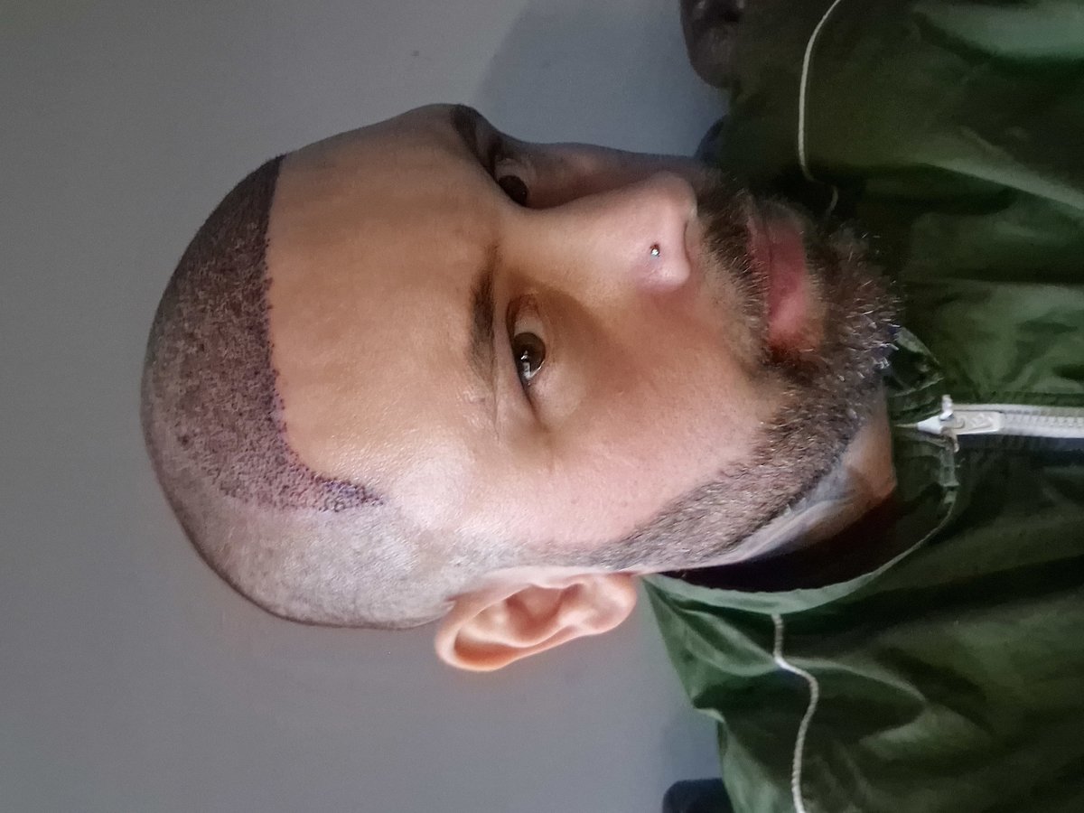 HCT Renova Clinic - HCT Renova Clinic