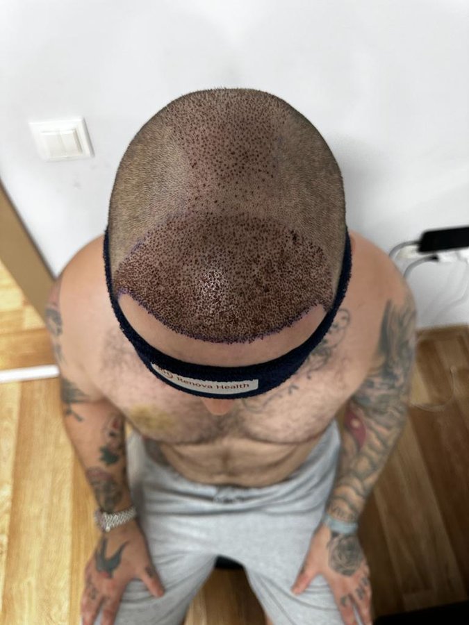 HCT Renova Clinic - HCT Renova Clinic