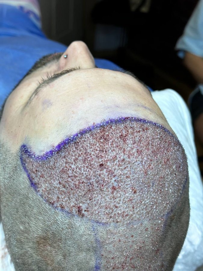 HCT Renova Clinic - HCT Renova Clinic