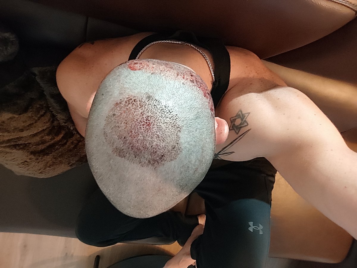 HDC Hair Transplant Clinic - HDC Hair Transplant Clinic